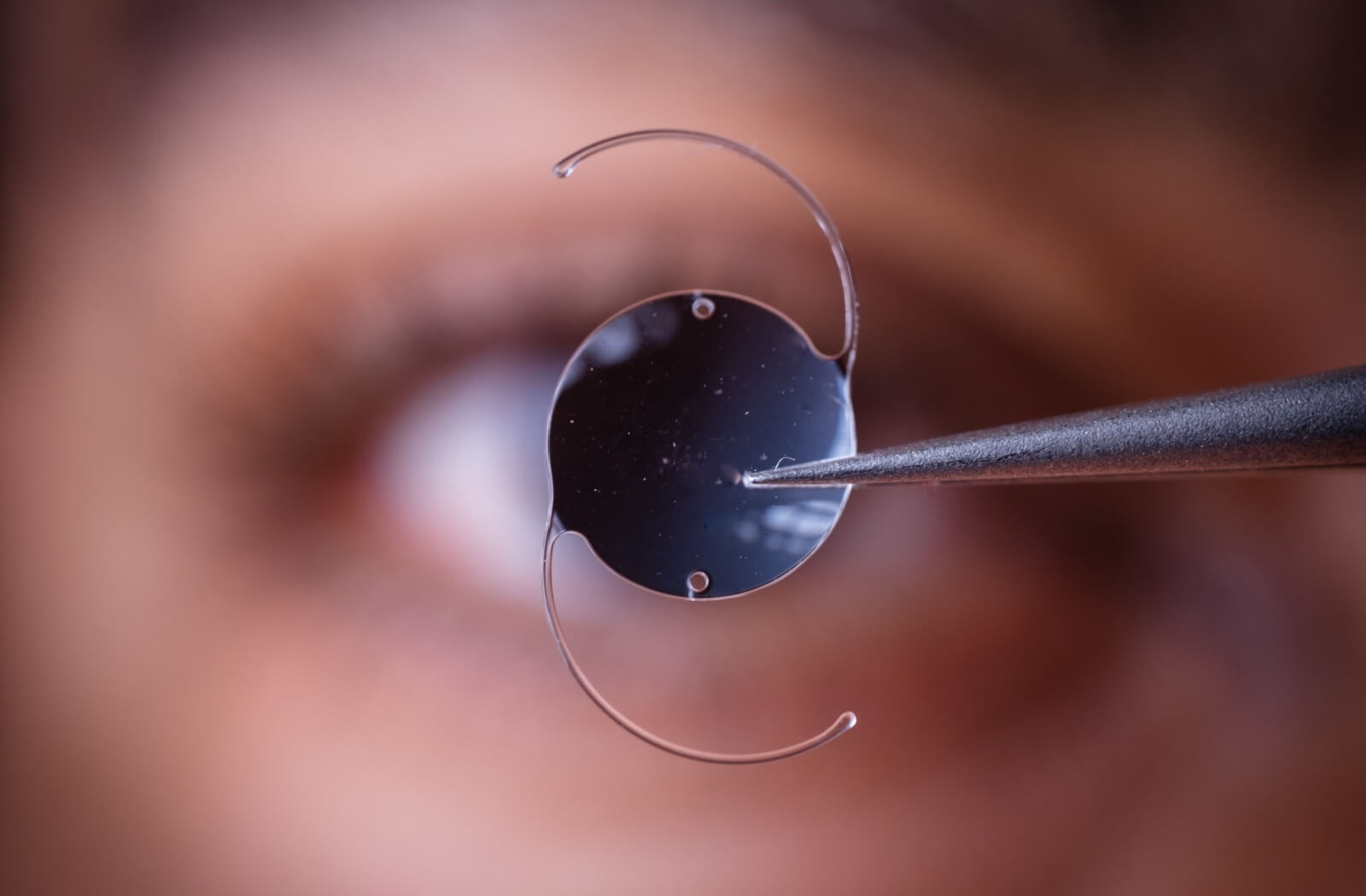 Comparação visual dos quatro tipos de lentes intraoculares: monofocal, tórica, EDOF e trifocal
